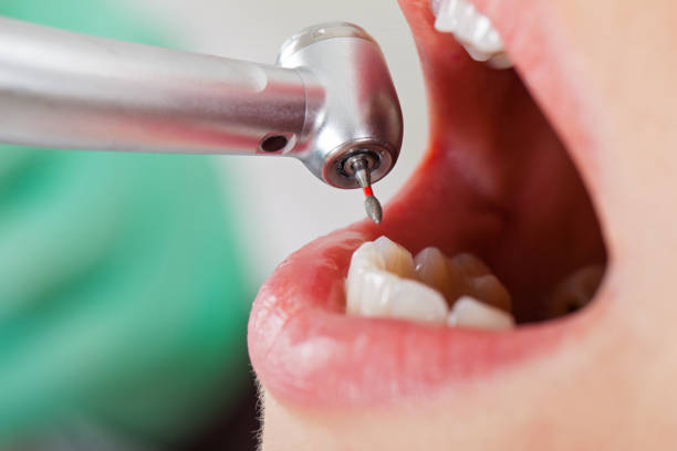 Best Emergency Gum Treatment in Latta, OK